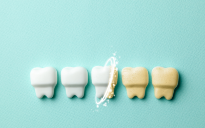 What Does Coffee Do To Your Teeth
